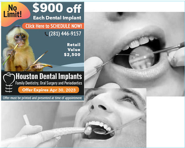 straight whitenened teeth with dental implants Jan 2023 coupon