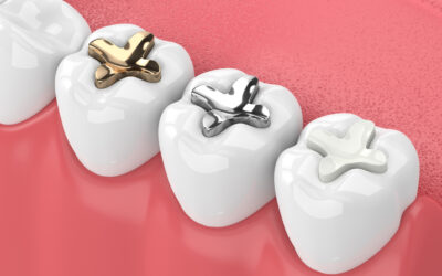 The Crown Debate: Porcelain vs. Metal in Dental Restoration