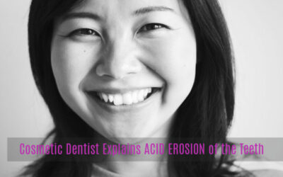 Cosmetic Dentist Explains Acid Erosion of the Teeth