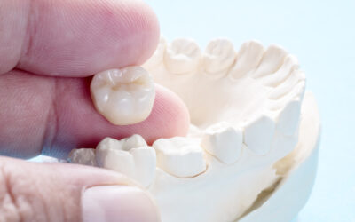 Are You a Candidate for Dental Crowns?