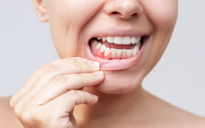 Gentle and Effective Gum Disease Management with Lasers