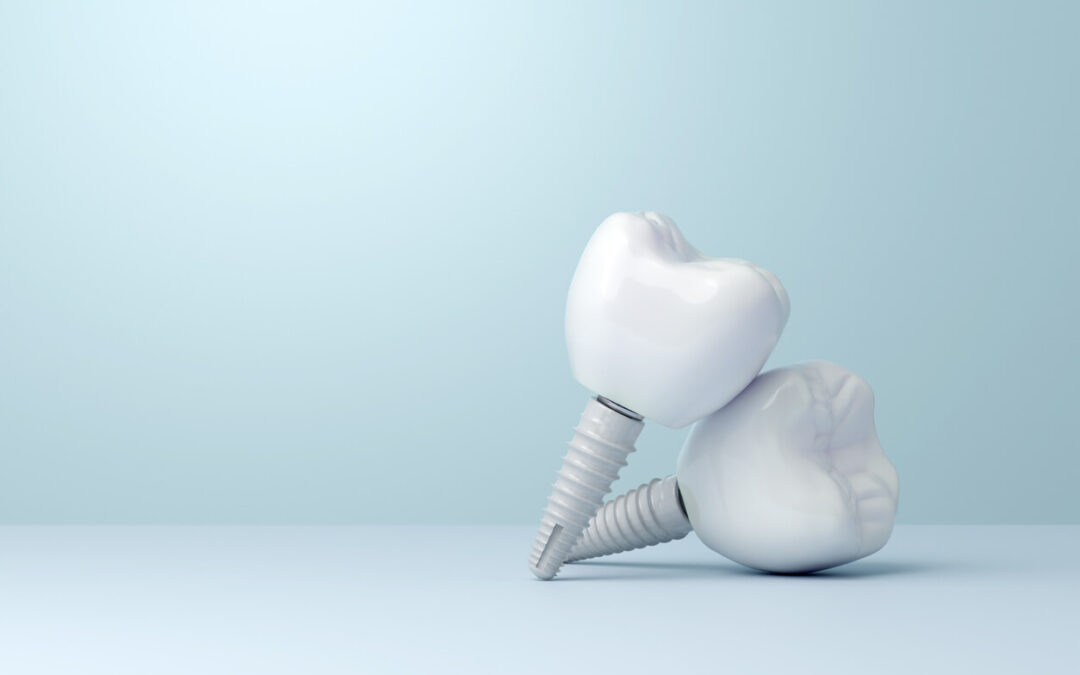 Zirconia Dental Implants Are Changing the Future of Tooth Replacement